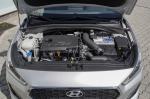 hyundai-i30-2018-diesel-1582cc