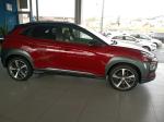 hyundai-kauai-2019-diesel-1598cc