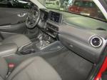 hyundai-kauai-2021-hibrido-a-diesel-1598cc